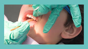 SDF Cavity Treatments ​in Pune