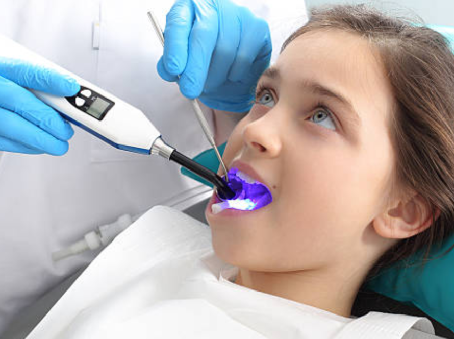 Dental Sealant Pune | Child Dentist Pune